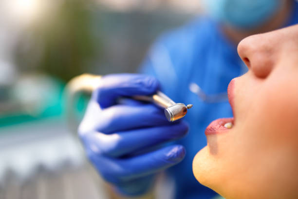 Dental Inlays and Onlays in Silver Springs Shores, FL
